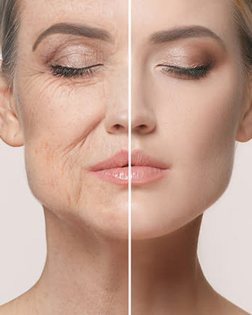 Anti-âge avec extraction