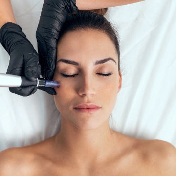 Microneedling