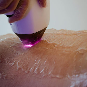 Consultation Laser